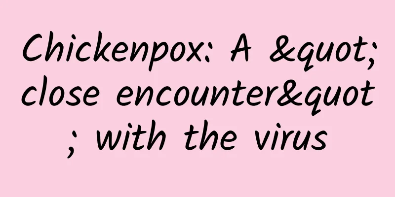 Chickenpox: A "close encounter" with the virus