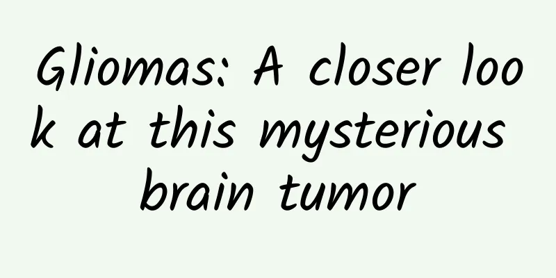 Gliomas: A closer look at this mysterious brain tumor