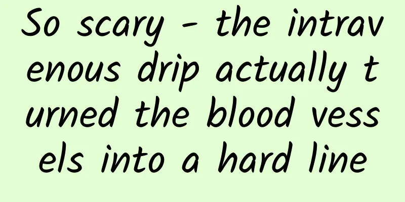 So scary - the intravenous drip actually turned the blood vessels into a hard line
