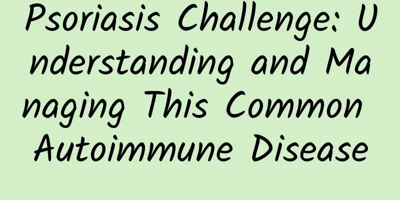 Psoriasis Challenge: Understanding and Managing This Common Autoimmune Disease