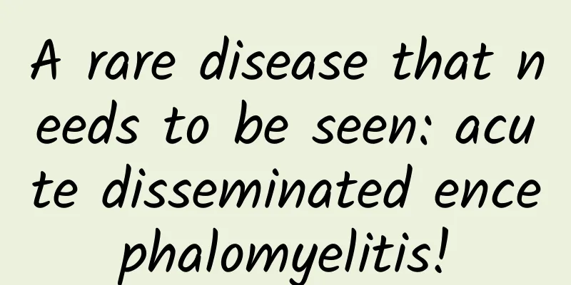A rare disease that needs to be seen: acute disseminated encephalomyelitis!
