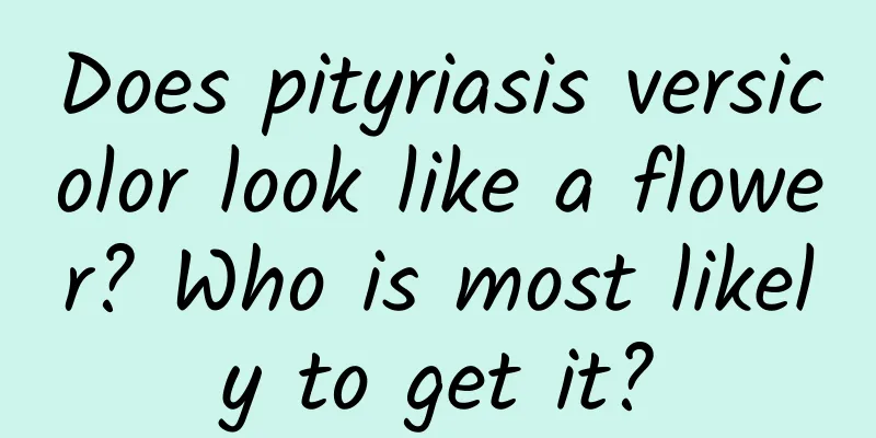 Does pityriasis versicolor look like a flower? Who is most likely to get it?