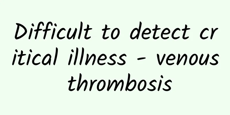 Difficult to detect critical illness - venous thrombosis