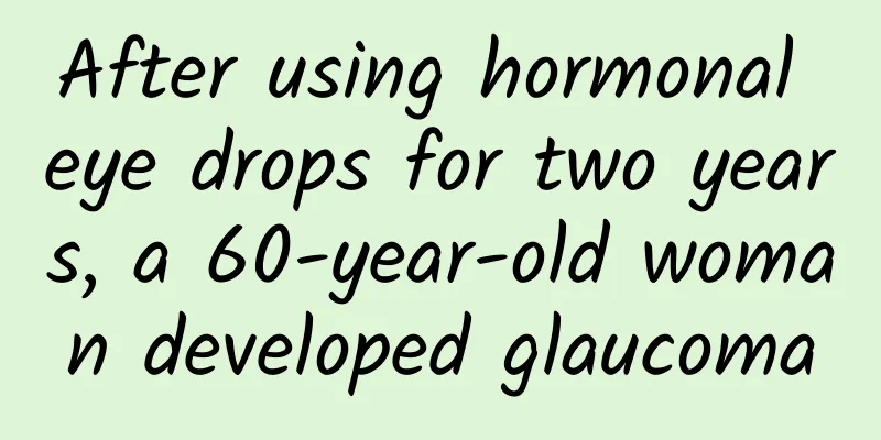After using hormonal eye drops for two years, a 60-year-old woman developed glaucoma