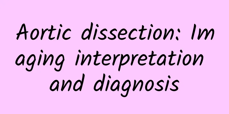 Aortic dissection: Imaging interpretation and diagnosis