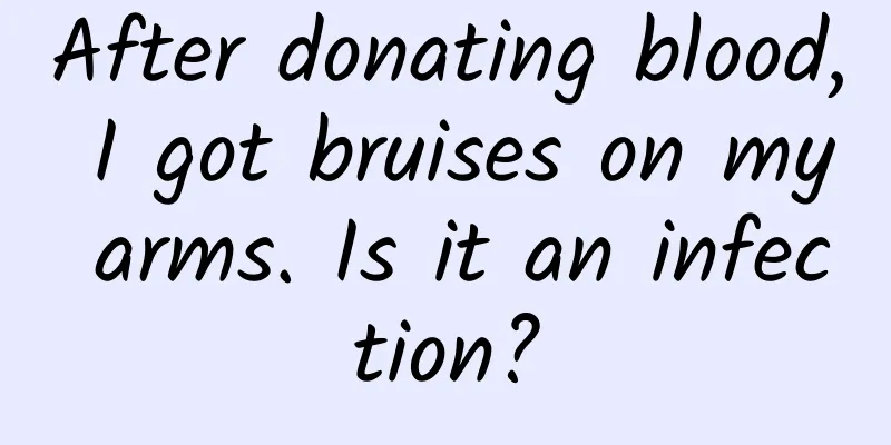 After donating blood, I got bruises on my arms. Is it an infection?