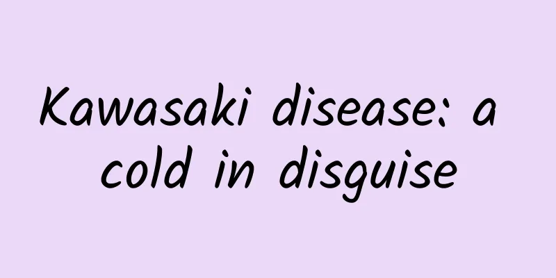 Kawasaki disease: a cold in disguise