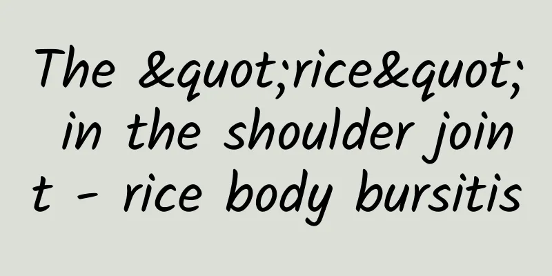 The "rice" in the shoulder joint - rice body bursitis