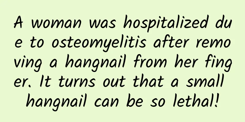 A woman was hospitalized due to osteomyelitis after removing a hangnail from her finger. It turns out that a small hangnail can be so lethal!