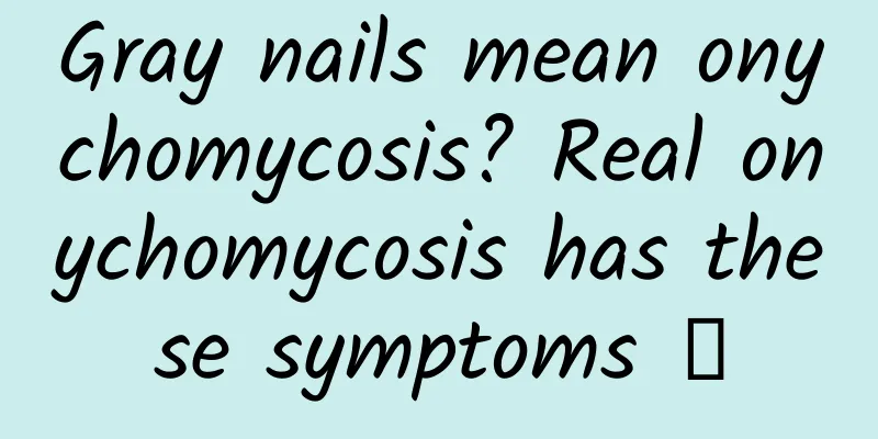 Gray nails mean onychomycosis? Real onychomycosis has these symptoms →