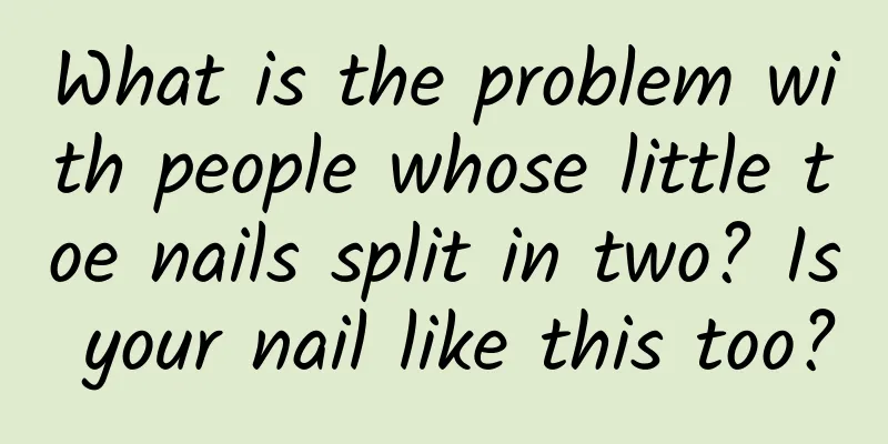 What is the problem with people whose little toe nails split in two? Is your nail like this too?
