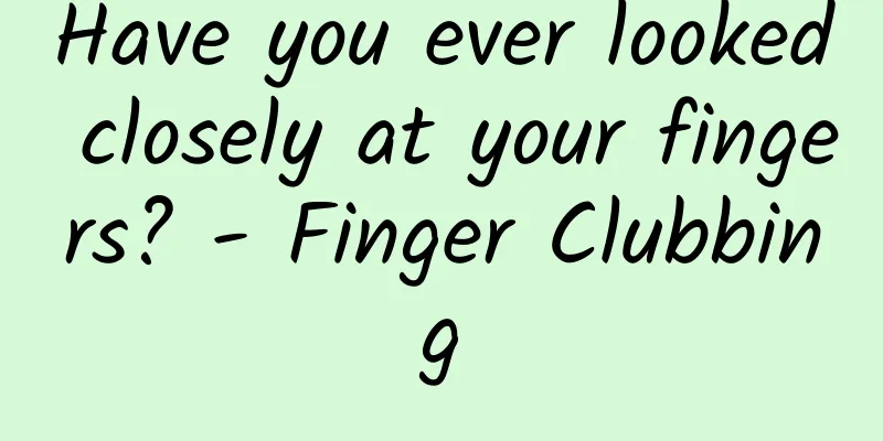 Have you ever looked closely at your fingers? - Finger Clubbing