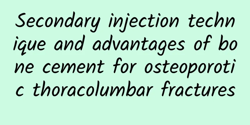 Secondary injection technique and advantages of bone cement for osteoporotic thoracolumbar fractures