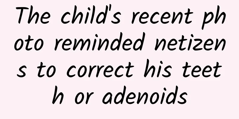 The child's recent photo reminded netizens to correct his teeth or adenoids
