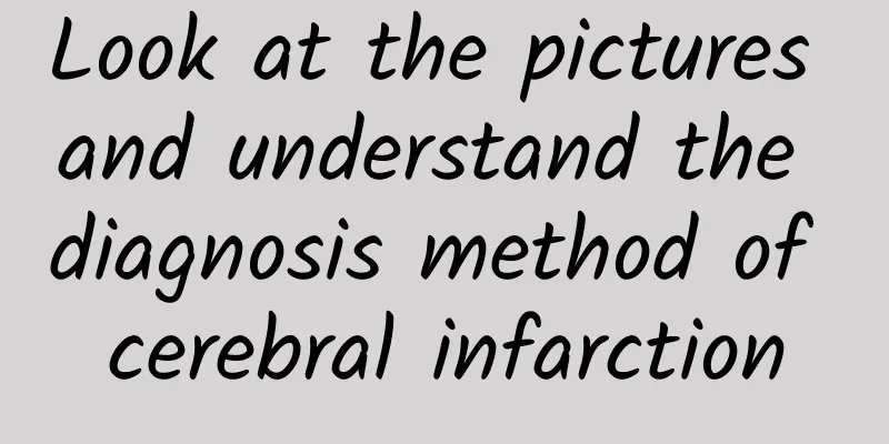 Look at the pictures and understand the diagnosis method of cerebral infarction