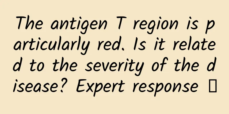 The antigen T region is particularly red. Is it related to the severity of the disease? Expert response →