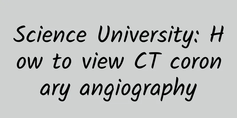 Science University: How to view CT coronary angiography