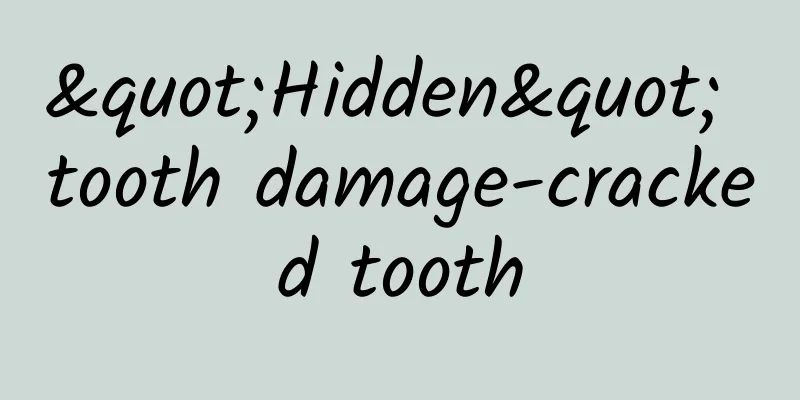 "Hidden" tooth damage-cracked tooth