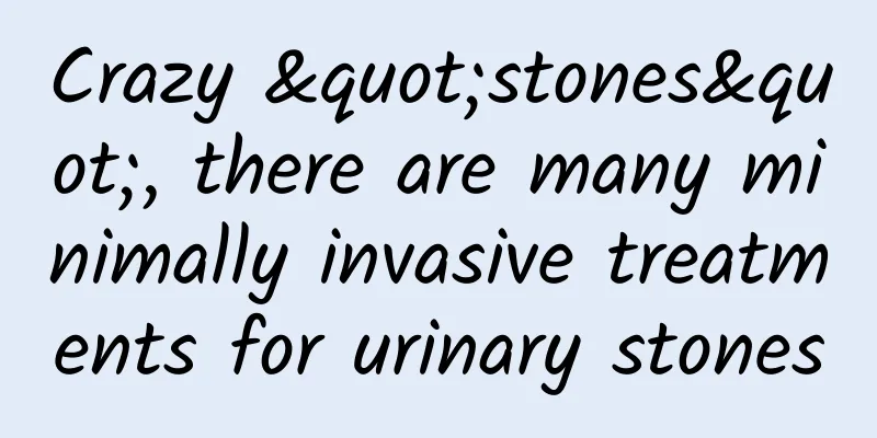 Crazy "stones", there are many minimally invasive treatments for urinary stones