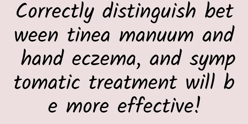 Correctly distinguish between tinea manuum and hand eczema, and symptomatic treatment will be more effective!