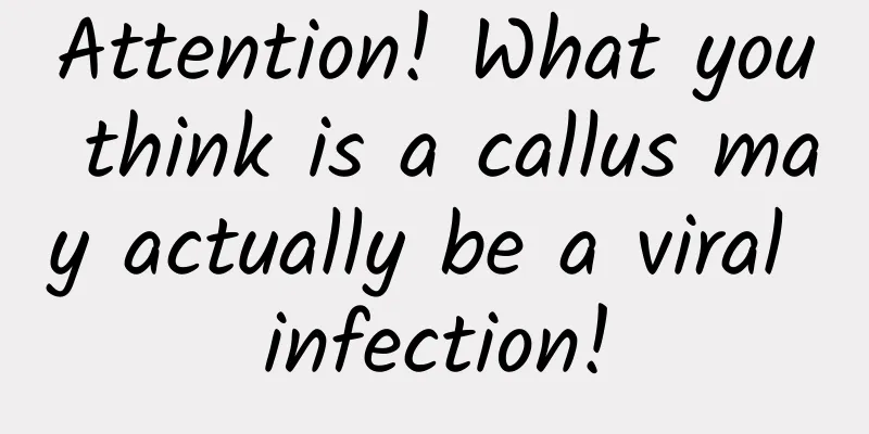 Attention! What you think is a callus may actually be a viral infection!