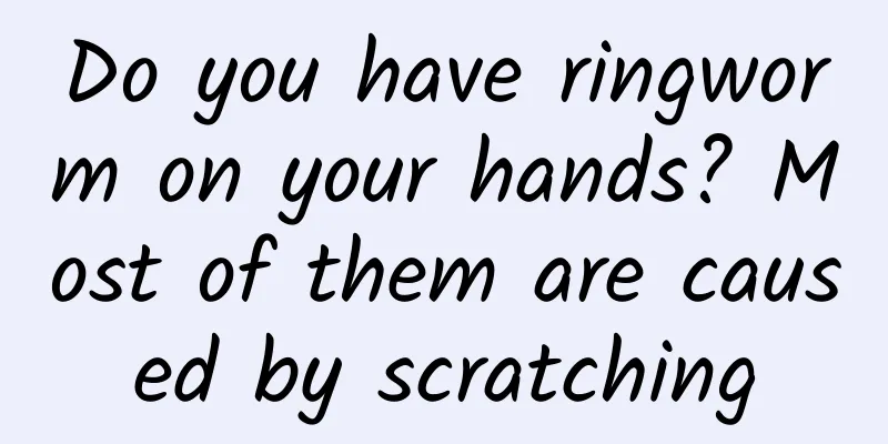 Do you have ringworm on your hands? Most of them are caused by scratching