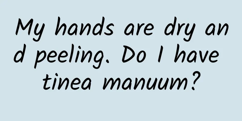 My hands are dry and peeling. Do I have tinea manuum?