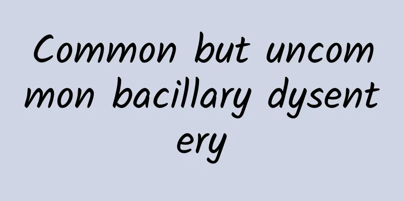 Common but uncommon bacillary dysentery