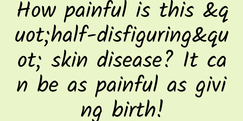 How painful is this "half-disfiguring" skin disease? It can be as painful as giving birth!