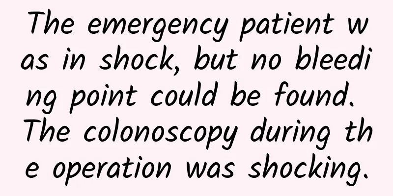 The emergency patient was in shock, but no bleeding point could be found. The colonoscopy during the operation was shocking.