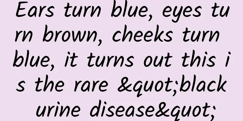 Ears turn blue, eyes turn brown, cheeks turn blue, it turns out this is the rare "black urine disease"