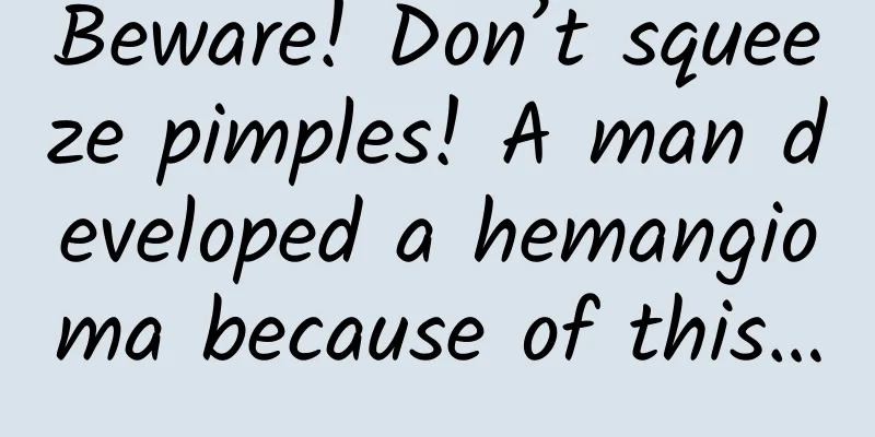 Beware! Don’t squeeze pimples! A man developed a hemangioma because of this…