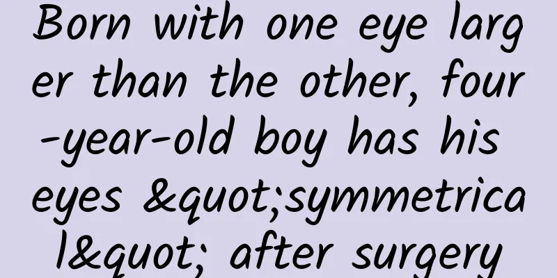 Born with one eye larger than the other, four-year-old boy has his eyes "symmetrical" after surgery
