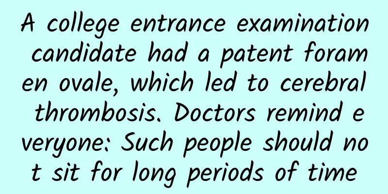 A college entrance examination candidate had a patent foramen ovale, which led to cerebral thrombosis. Doctors remind everyone: Such people should not sit for long periods of time