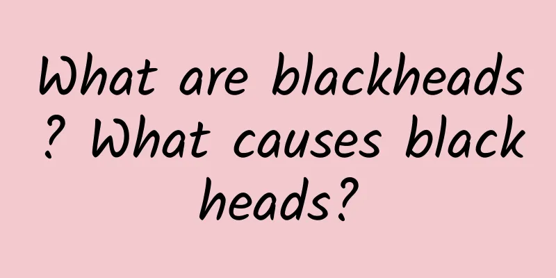 What are blackheads? What causes blackheads?