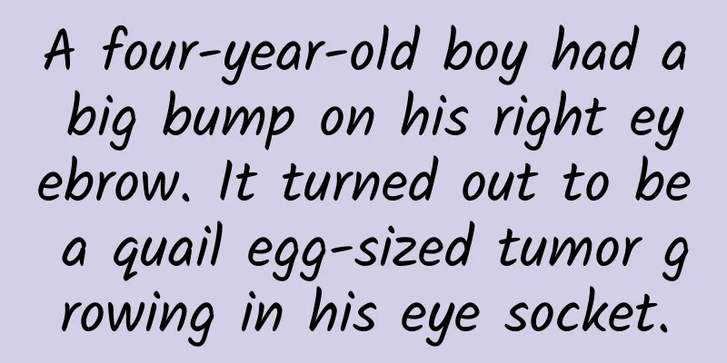 A four-year-old boy had a big bump on his right eyebrow. It turned out to be a quail egg-sized tumor growing in his eye socket.