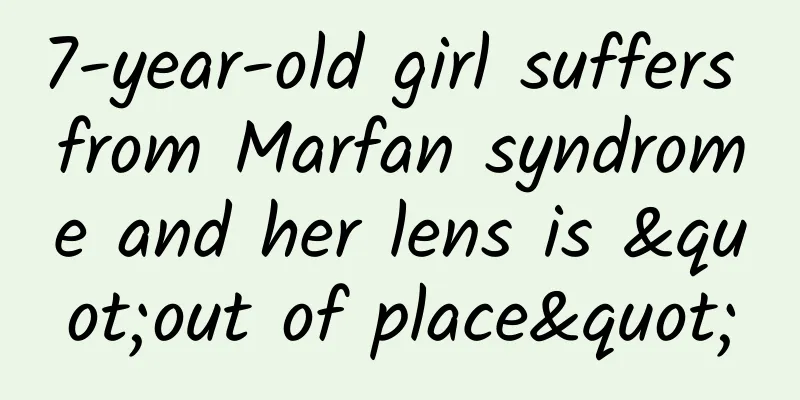 7-year-old girl suffers from Marfan syndrome and her lens is "out of place"