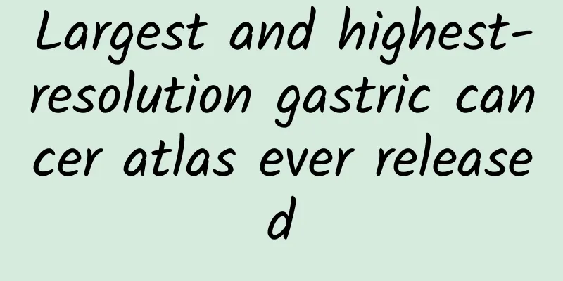 Largest and highest-resolution gastric cancer atlas ever released