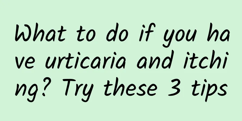 What to do if you have urticaria and itching? Try these 3 tips
