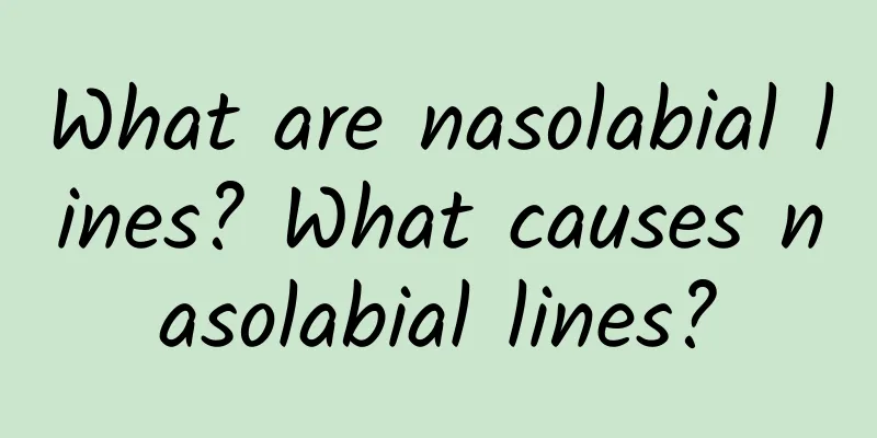 What are nasolabial lines? What causes nasolabial lines?