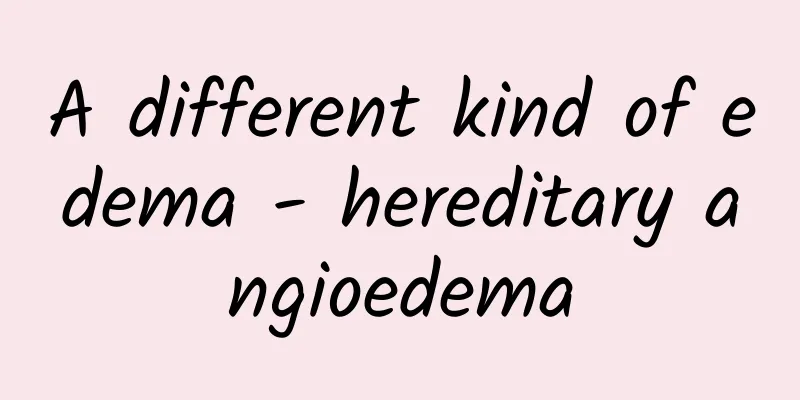 A different kind of edema - hereditary angioedema