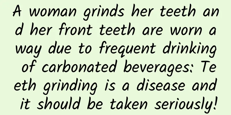 A woman grinds her teeth and her front teeth are worn away due to frequent drinking of carbonated beverages: Teeth grinding is a disease and it should be taken seriously!