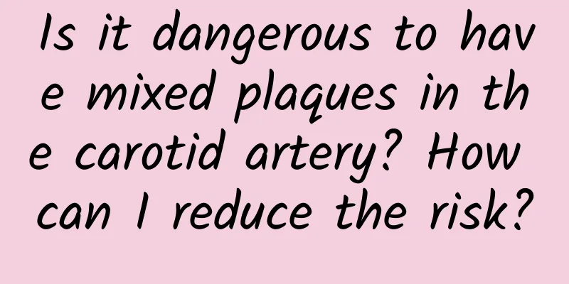 Is it dangerous to have mixed plaques in the carotid artery? How can I reduce the risk?