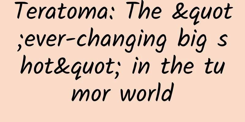 Teratoma: The "ever-changing big shot" in the tumor world