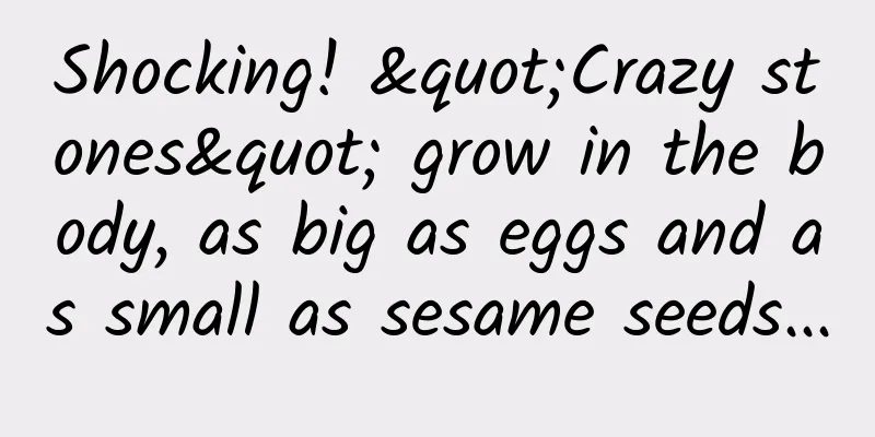 Shocking! "Crazy stones" grow in the body, as big as eggs and as small as sesame seeds...