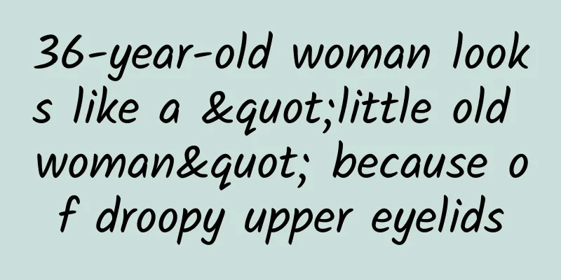 36-year-old woman looks like a "little old woman" because of droopy upper eyelids