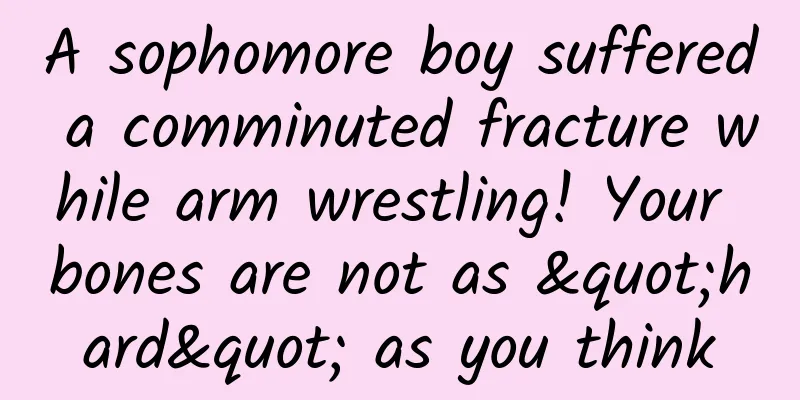 A sophomore boy suffered a comminuted fracture while arm wrestling! Your bones are not as "hard" as you think