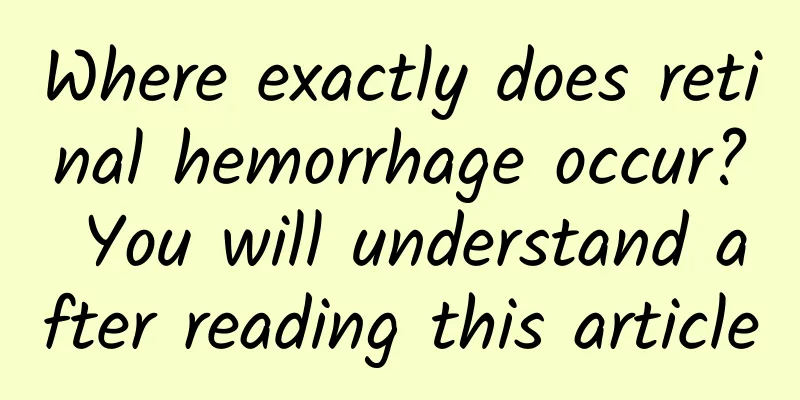 Where exactly does retinal hemorrhage occur? You will understand after reading this article