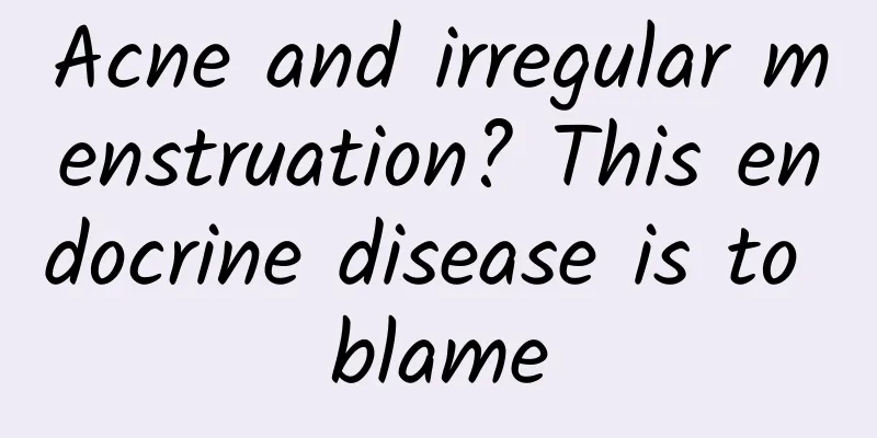 Acne and irregular menstruation? This endocrine disease is to blame
