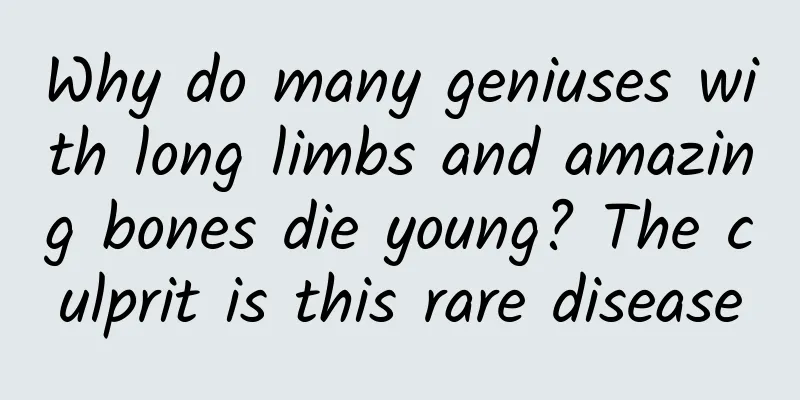 Why do many geniuses with long limbs and amazing bones die young? The culprit is this rare disease
